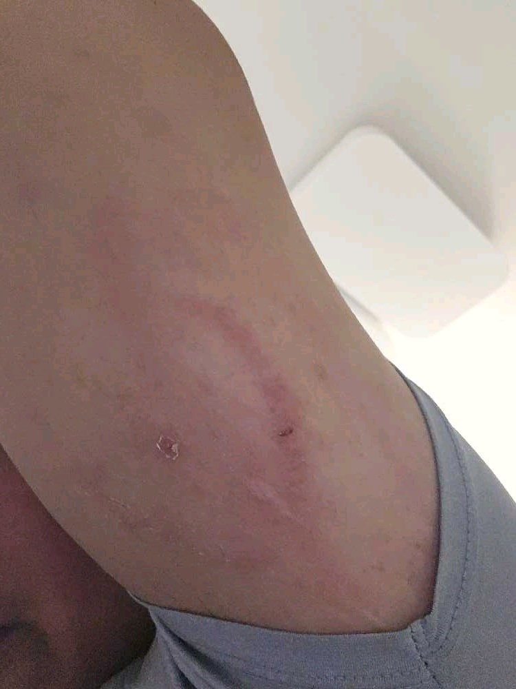 사용자 첨부 사진